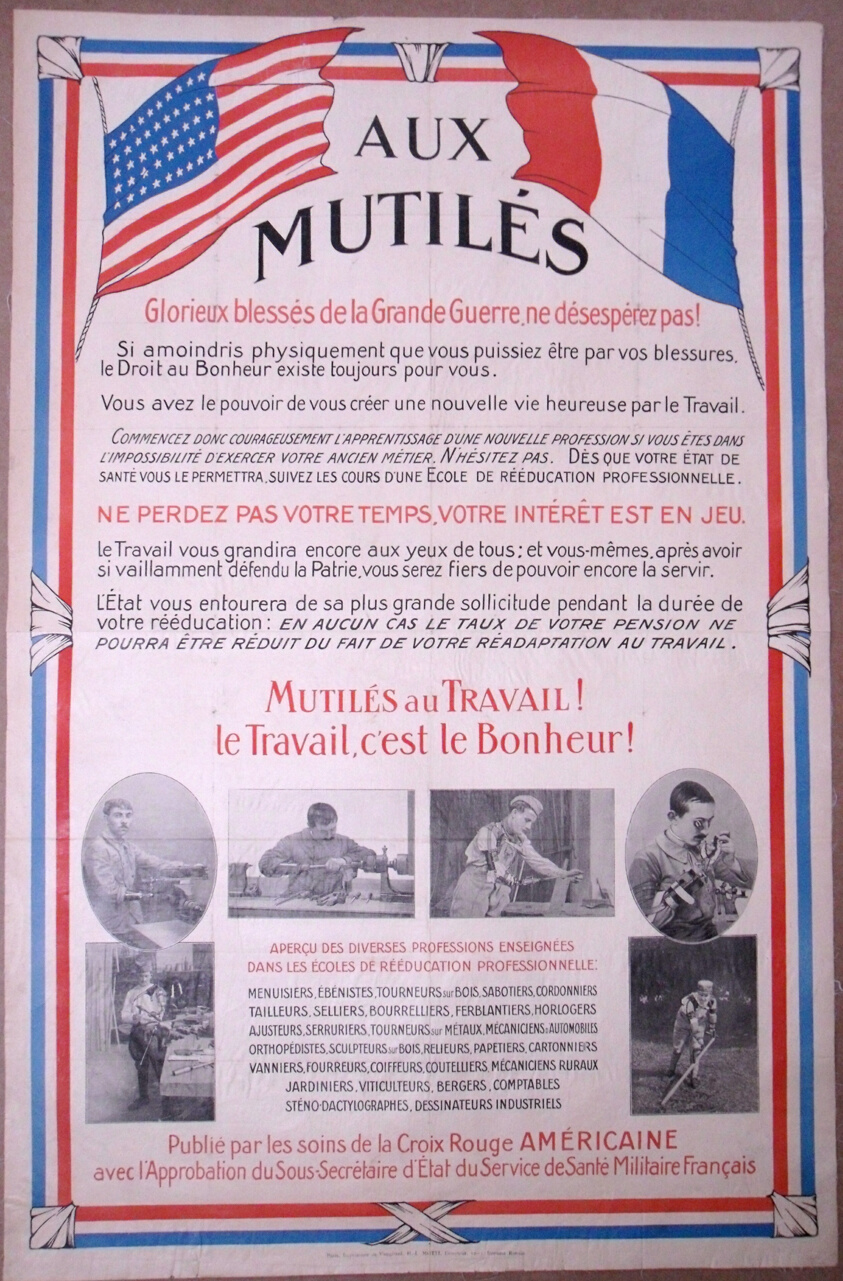 To the Amputees—Join the Workforce